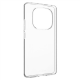 Fixed Story | Back Cover | Xiaomi | Redmi Note 14 Pro 5G/POCO X7 | TPU | Clear